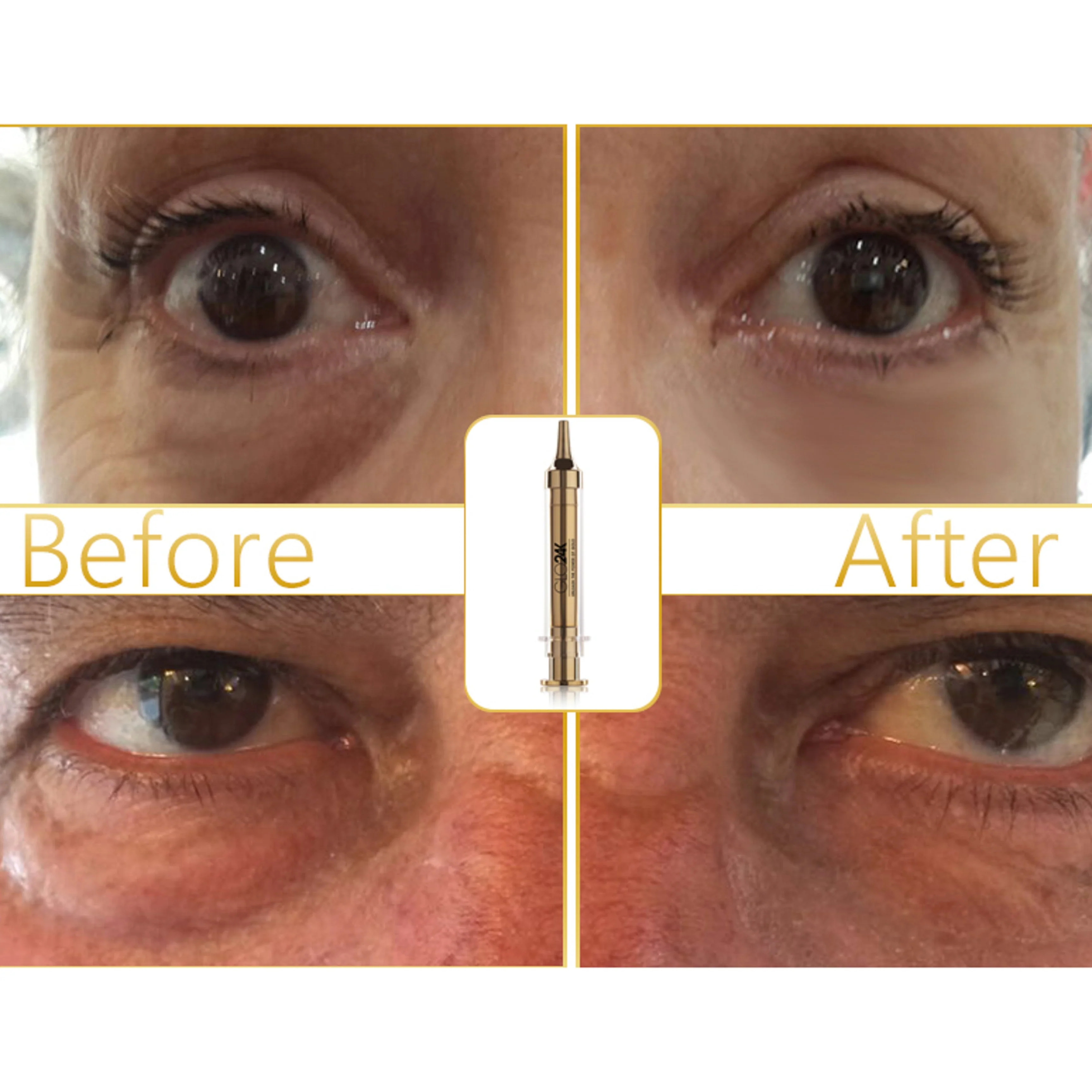 Express Non-Surgical Anti-Aging Facelift Cream - Image 2