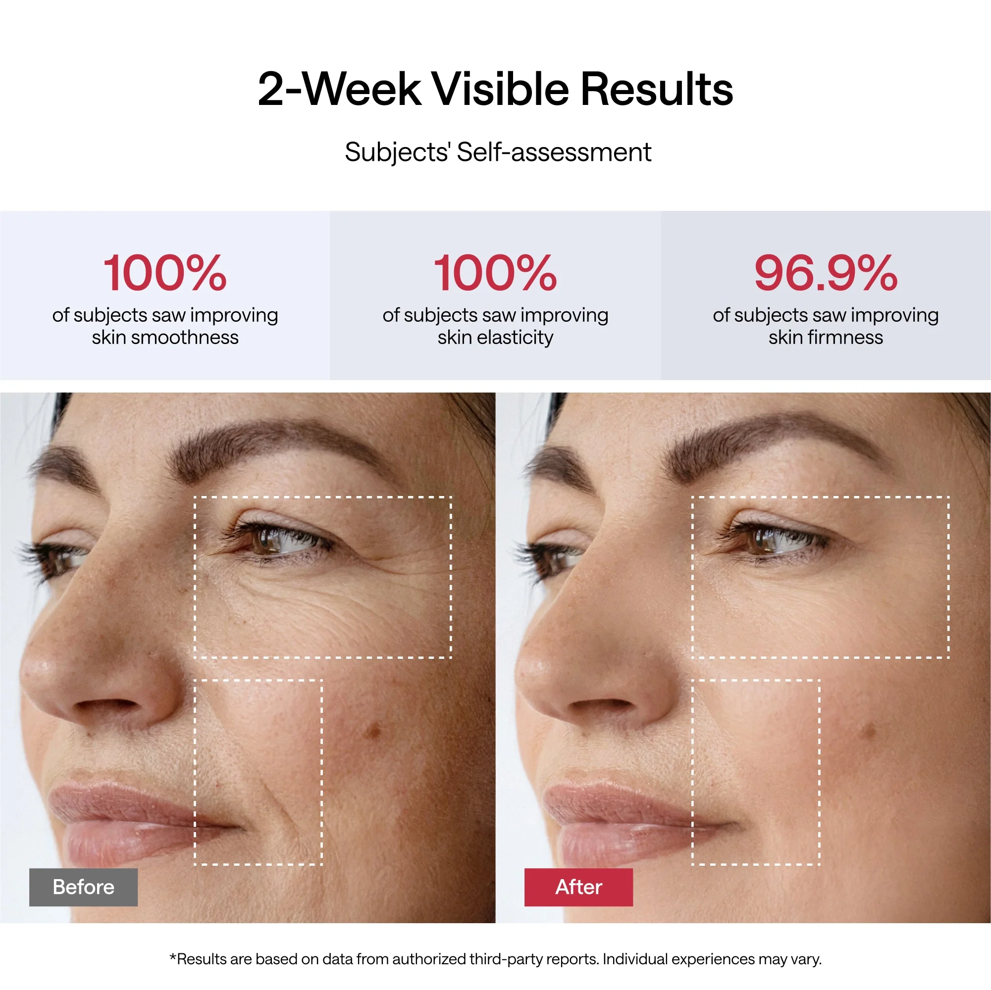 JMOON UCOLLAGEN+ Bundle (Device, 3Gel, 1Brush, 1Accessory Bag) - Image 4